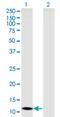 Solute Carrier Family 22 Member 18 Antisense antibody, H00005003-M05, Novus Biologicals, Western Blot image 