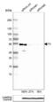 Coagulation Factor III, Tissue Factor antibody, NBP2-61640, Novus Biologicals, Western Blot image 