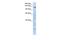 Formin Like 2 antibody, A05878, Boster Biological Technology, Western Blot image 