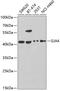 Gap Junction Protein Alpha 4 antibody, GTX54119, GeneTex, Western Blot image 