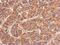 Heat Shock Protein Family A (Hsp70) Member 4 antibody, NBP2-16898, Novus Biologicals, Immunohistochemistry frozen image 