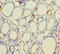 Thyroid Peroxidase antibody, A56687-100, Epigentek, Immunohistochemistry paraffin image 