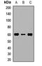 Ribosomal Protein S6 Kinase Like 1 antibody, orb412620, Biorbyt, Western Blot image 
