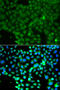 Fyn Related Src Family Tyrosine Kinase antibody, 23-025, ProSci, Immunofluorescence image 