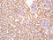 Sirtuin 4 antibody, GTX51798, GeneTex, Immunohistochemistry paraffin image 