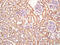 NAD-dependent ADP-ribosyltransferase sirtuin-4 antibody, GTX51798, GeneTex, Immunohistochemistry paraffin image 