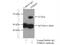 Tudor and KH domain-containing protein antibody, 13528-1-AP, Proteintech Group, Immunoprecipitation image 