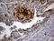 Protein Phosphatase 2 Scaffold Subunit Abeta antibody, LS-C795945, Lifespan Biosciences, Immunohistochemistry paraffin image 