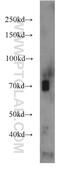 Adenosine Monophosphate Deaminase 3 antibody, 23997-1-AP, Proteintech Group, Western Blot image 