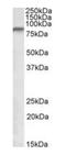 NADH:Ubiquinone Oxidoreductase Core Subunit S1 antibody, orb20594, Biorbyt, Western Blot image 