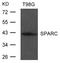 SPARC antibody, GTX50807, GeneTex, Western Blot image 