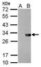 Herpes Simplex Virus tag antibody, NBP2-43734, Novus Biologicals, Western Blot image 