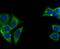 Ubiquitin Specific Peptidase 10 antibody, NBP2-75698, Novus Biologicals, Immunofluorescence image 