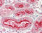 Adipocyte Plasma Membrane Associated Protein antibody, LS-C452500, Lifespan Biosciences, Immunohistochemistry paraffin image 