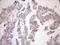 Cytokine Induced Apoptosis Inhibitor 1 antibody, LS-C794546, Lifespan Biosciences, Immunohistochemistry paraffin image 