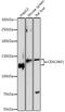 Carcinoembryonic Antigen Related Cell Adhesion Molecule 1 antibody, A1702, ABclonal Technology, Western Blot image 