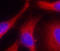 Serine/threonine-protein kinase D1 antibody, LS-C335820, Lifespan Biosciences, Immunofluorescence image 