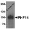 PHD Finger Protein 14 antibody, A13413, Boster Biological Technology, Immunofluorescence image 
