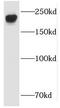 Rho Guanine Nucleotide Exchange Factor 12 antibody, FNab04696, FineTest, Western Blot image 