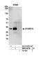 StAR Related Lipid Transfer Domain Containing 10 antibody, NBP2-60729, Novus Biologicals, Western Blot image 