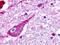 G Protein-Coupled Receptor 179 antibody, GTX71063, GeneTex, Immunohistochemistry paraffin image 