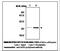 Superoxide Dismutase 2 antibody, LS-C61936, Lifespan Biosciences, Immunoprecipitation image 
