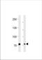 PID antibody, TA324856, Origene, Western Blot image 