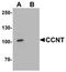 Cyclin T1 antibody, A02703, Boster Biological Technology, Western Blot image 