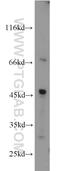 Glycogenin 2 antibody, 13150-1-AP, Proteintech Group, Western Blot image 