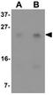 Lymphocyte antigen 6K antibody, GTX16304, GeneTex, Western Blot image 