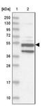 Xylulokinase antibody, NBP1-87919, Novus Biologicals, Western Blot image 