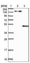 Potassium Voltage-Gated Channel Subfamily J Member 5 antibody, NBP1-88082, Novus Biologicals, Western Blot image 