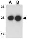 Synaptogyrin 3 antibody, GTX31397, GeneTex, Western Blot image 
