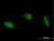 Adenosine Deaminase RNA Specific B1 antibody, H00000104-B02P, Novus Biologicals, Immunocytochemistry image 