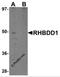 Rhomboid Domain Containing 1 antibody, A09636, Boster Biological Technology, Western Blot image 
