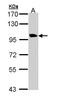 Transmembrane Protein 67 antibody, LS-C186138, Lifespan Biosciences, Western Blot image 