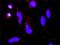 Coagulation Factor III, Tissue Factor antibody, H00002152-M01, Novus Biologicals, Proximity Ligation Assay image 