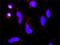 CD142 antibody, H00002152-M01, Novus Biologicals, Proximity Ligation Assay image 