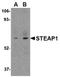 STEAP Family Member 1 antibody, AP05708PU-N, Origene, Western Blot image 