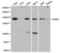 SIN3 Transcription Regulator Family Member A antibody, MBS127794, MyBioSource, Western Blot image 