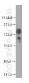 Gamma-adducin antibody, 17585-1-AP, Proteintech Group, Western Blot image 