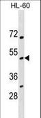 NADPH Oxidase Organizer 1 antibody, LS-C158415, Lifespan Biosciences, Western Blot image 