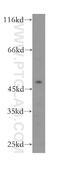 Centromere Protein L antibody, 17007-1-AP, Proteintech Group, Western Blot image 