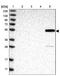 Aldehyde Dehydrogenase 8 Family Member A1 antibody, NBP1-89151, Novus Biologicals, Western Blot image 