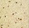 Core-Binding Factor Subunit Beta antibody, LS-C168351, Lifespan Biosciences, Immunohistochemistry paraffin image 