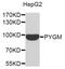 Glycogen Phosphorylase, Muscle Associated antibody, PA5-76432, Invitrogen Antibodies, Western Blot image 