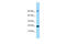 Adenosine Deaminase TRNA Specific 2 antibody, ARP66713_P050, Aviva Systems Biology, Western Blot image 