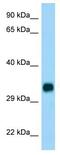 Cholesterol 25-Hydroxylase antibody, ab133933, Abcam, Western Blot image 