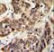 Serine/Threonine Kinase 32A antibody, LS-C161561, Lifespan Biosciences, Immunohistochemistry paraffin image 