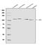 Eukaryotic Translation Initiation Factor 3 Subunit C antibody, A06470-1, Boster Biological Technology, Western Blot image 